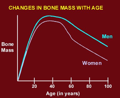 Men and Osteoporosis