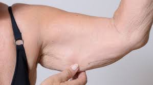 Symptoms And Causes of Sarcopenia